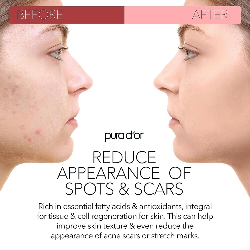 Aceite de semilla de rosa mosqueta orgánico PURA D'OR Dor 100 % puro para piel y cabello antienvejecimiento, 4 oz Foto 4 de 4