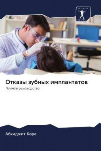 Thumbnail - Otkazy Zubnyh Implantatow Polnoe Rukowodstwo 6208