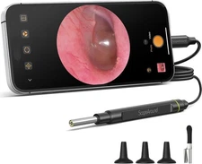 ScopeAround 3.9mm Digital Otoscope Camera 1080P FHD Ear Wax Removers with Light