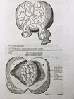 Gynecology 1614 Obstetrics Fertility Rousset Engraving Ambroise Paré