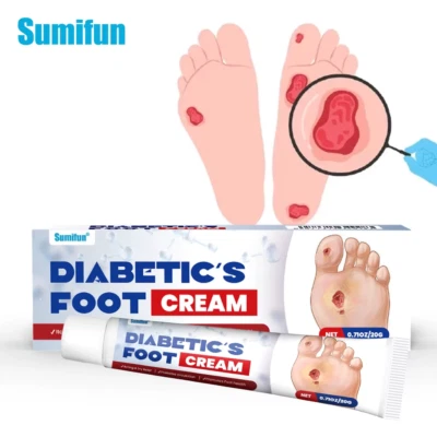SUMIFUN 20g New Diabetic Foot Cream Ulceration Feet Erosions Anti Itchy Skin Repair