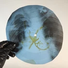 LED ZEPPELIN BLACK DOG X-Ray USSR Record Roentgen Bone Ribs Music Vinyl