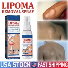 1-5PC Lipomheilung Reduction Spray,Instant LumpFree Lipoma Removal Spray USA Hot
