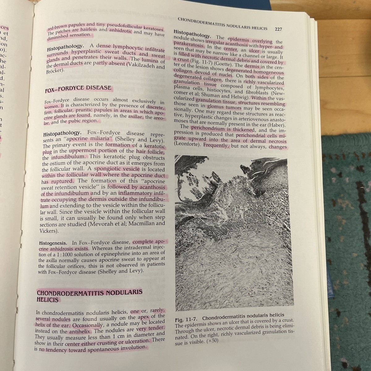 HISTOPATHOLOGY OF THE SKIN Lever/Schaumberg-Lever 7th Ed. 1990 | eBay