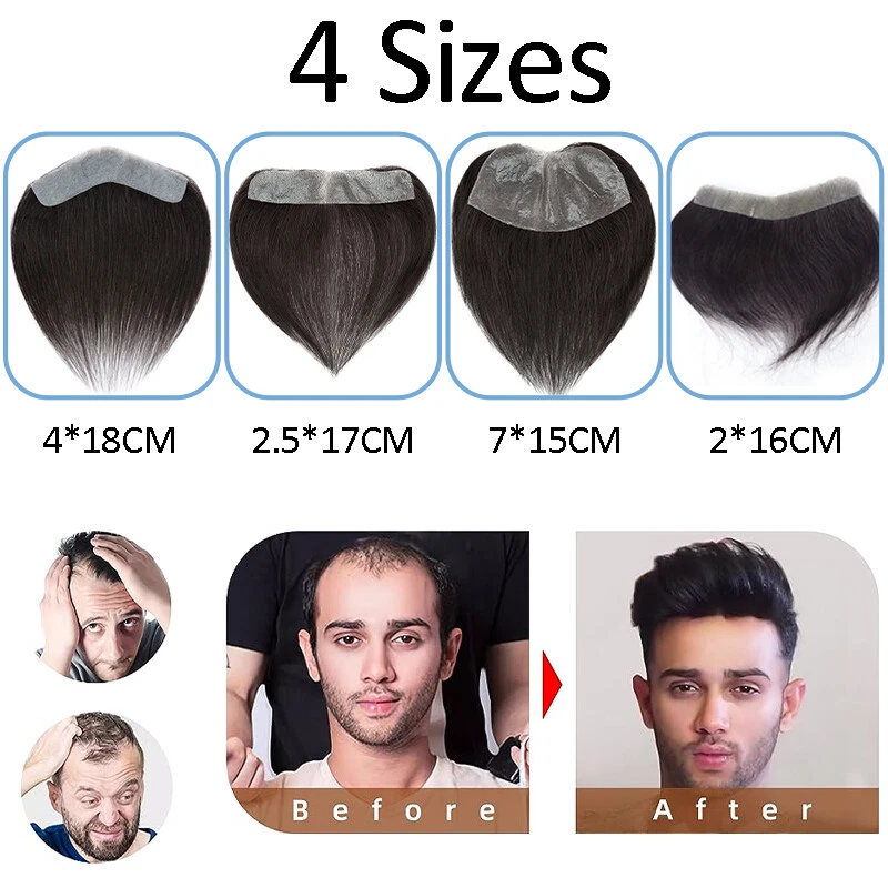 Natural Front Hairline Toupee Real Remy Human Hair for Men Replacement Hairpiece - Image 2 of 4
