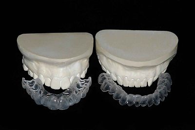  Custom Teeth Whitening Bleaching Tray Kit *Whiter Smile Labs* Dental Lab Direct