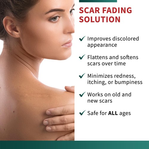 Medical Grade Silicone Scar Tape Advanced Adhesive Formulation (1.6" X 118") - Picture 5 of 7