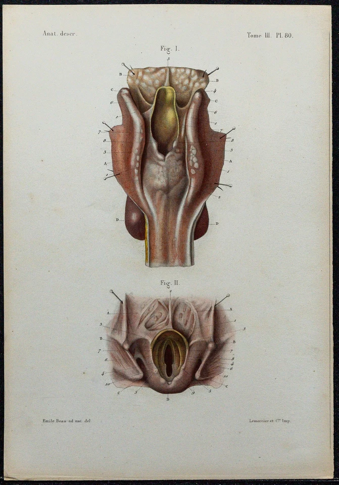 1866 - Larynx - Anatomy & Ear Nose & Throat - engraving antique