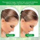 ROSEMARY Essential Oil Hair Growth Strengthening HAIR TREATMENT, Skin Care 30ml
