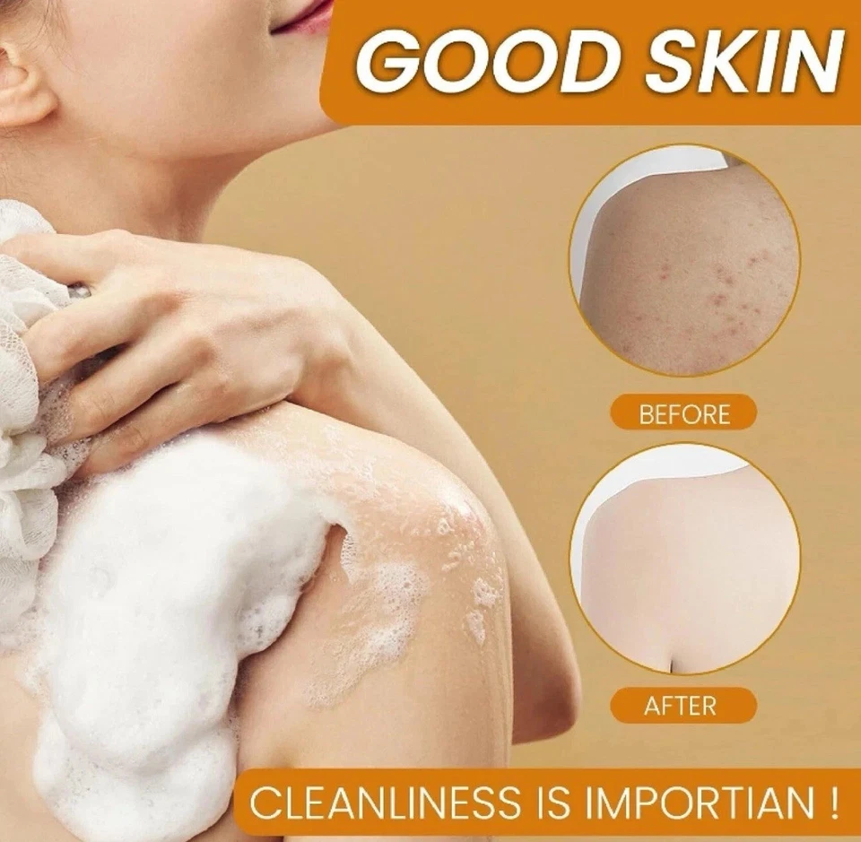 Paquete de 2 jabones tuméricos de limón + ácido kójico blanqueador de manchas oscuras de la piel 3,53 oz Foto 2 de 4