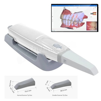 High-speed Digital Dental Intraoral Scanner Fast Shipping