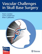 Vascular Challenges in Skull Base Surgery by Paul Gardner (English) Hardcover Bo