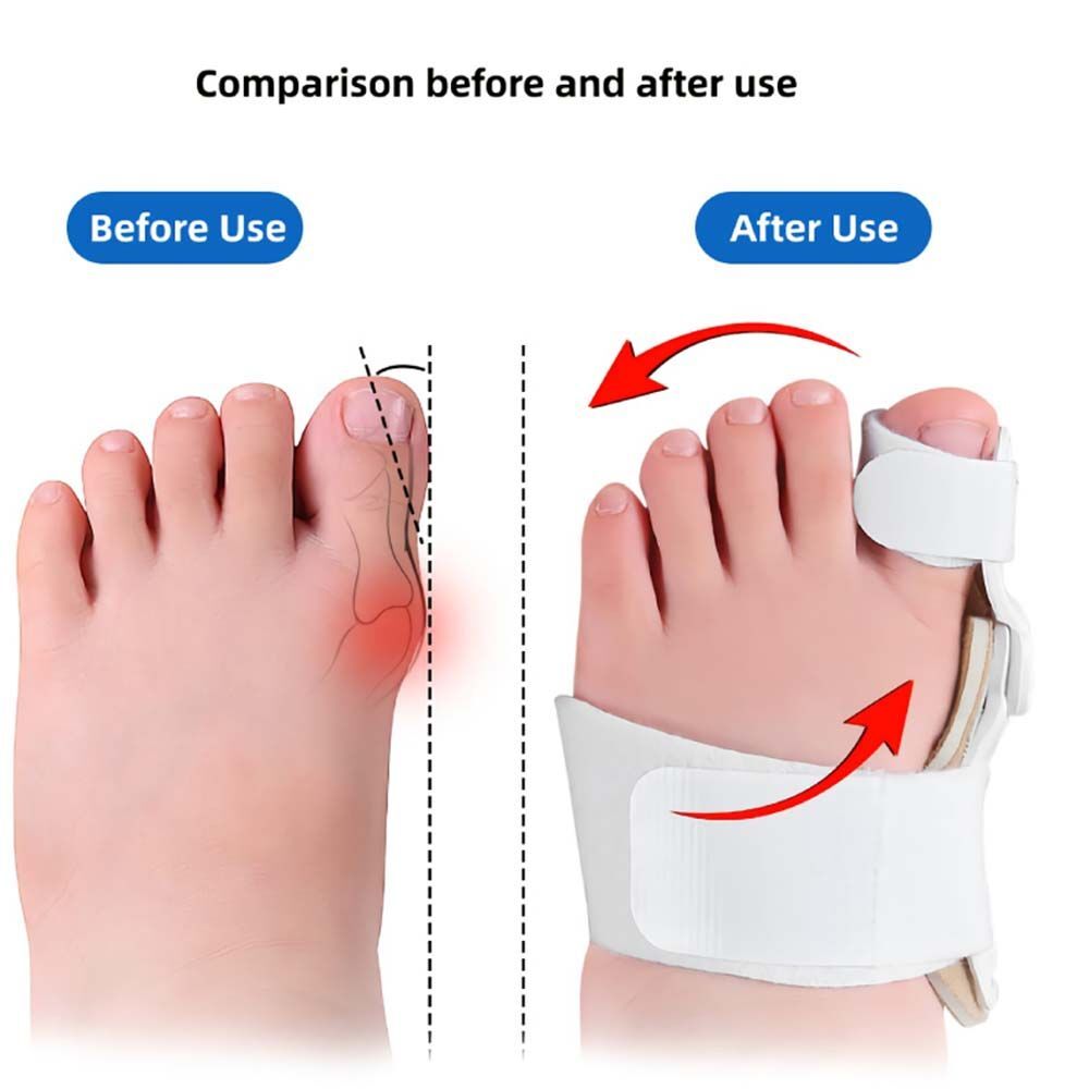 Straightener Toe Valgus Corrector Children Toe Separators Bunion Splint