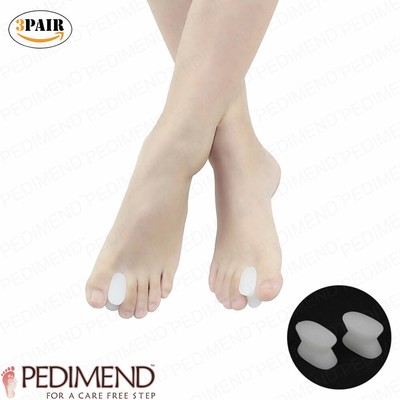 correcting soft corns