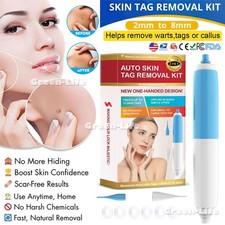 Painless Skin Tag Mole Wart Removal Kit, Auto SKIN TAG Bands Remover Pen Sets