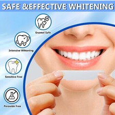 Kit Tiras Blanqueamiento Dental Blanqueadora Blanqueador De Dientes Profesional