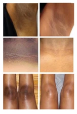 Dark Skin Bleaching Cream Whitening Lightening AHA - Face & Body, Max Strength