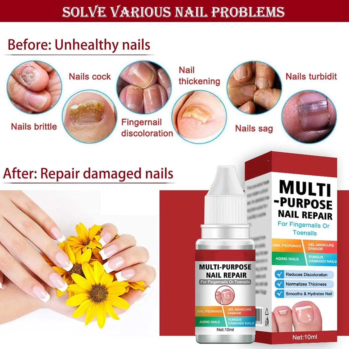 Details more than 131 nail fungus fingernail treatment best