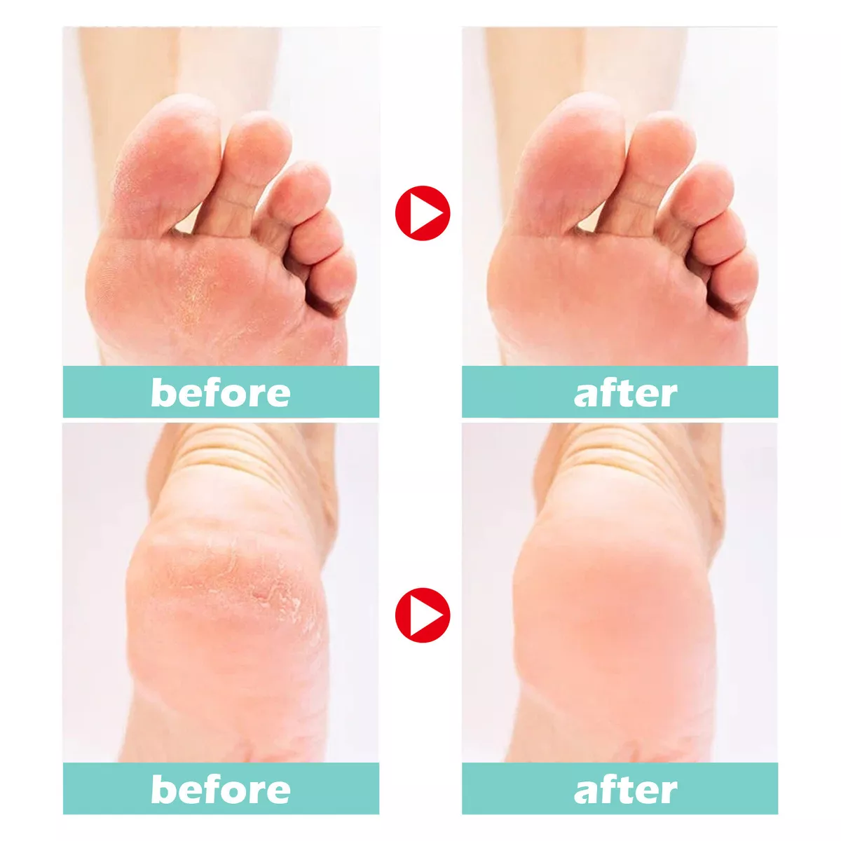 Cracked heel deals cream australia