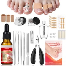 Ingrown Toenail Removal Kit, Professional Ingrown Toenail Treatment, Ingrown ...