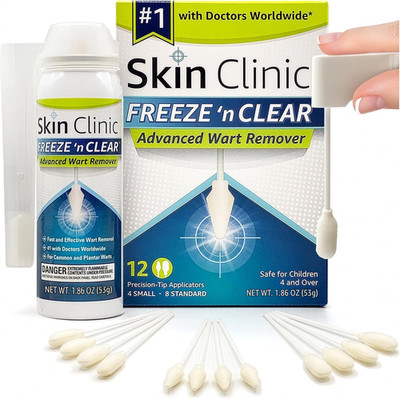 Skin Clinic Freeze 'N Clear Advanced Wart Remover - USA Made Cryo-Freeze Kit wit