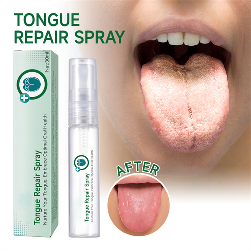 Spray reparador de lengua 2 piezas 30 ml spray para reducir la hinchazón alivio de la lengua spray - Imagen 3 de 10