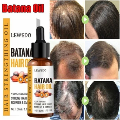 LEWEDO Batana Oil Essence for Healthier,Thicker Hair Growth and Anti-Hair Loss 50ML