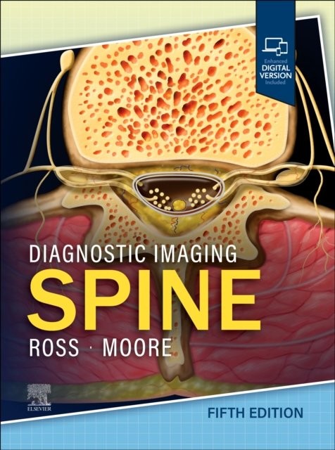 Diagnostic Imaging: Spine Ross Moore Hardback Elsevier 9780443378812 5e