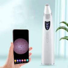 Electric Visual Blackhead Remover