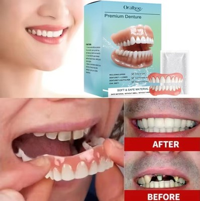 Resin DIY Dentures Veneers Set For Men And Women Upper And Lower False Teeth