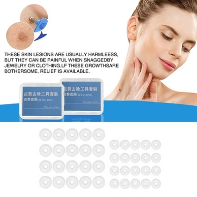 20Pcs Skin Tag Removal Rubber Bands Safe Micro Band Non Toxic Mole Wart Sk$g