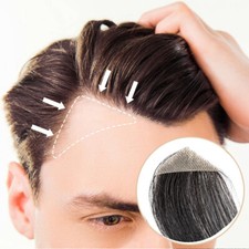 Temple Hair Patches Human Hair Pieces Skin Base Cover-Up Frontal Hairline Toupee