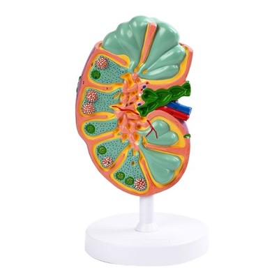Anatomical Human Lymphatic Structure Model Teaching Aid for Clinical Training