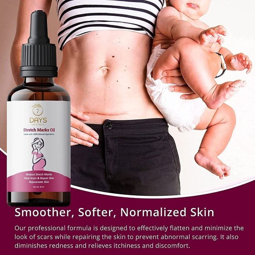 Pregnant Women Belly Bum Body Cellulite Stretch Marks Fast Removal Oil Serum - Picture 2 of 5