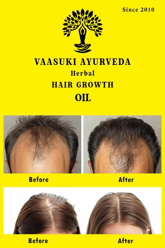 Premium Ayurveda Hair Oil 100ml - Herbal Remedy for Hair Loss & Growth - Image 3 of 4