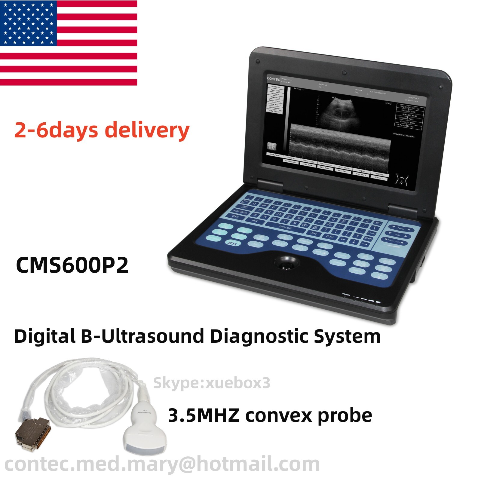 Ultrasound Scanner Digital Laptop Machine CMS600P2+3.5Mhz Convex Probe Abdominal