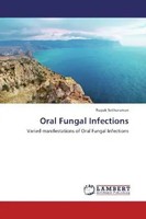 Rupak Sethuraman | Oral Fungal Infections | Taschenbuch | Englisch