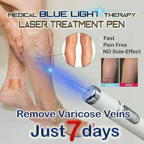 Blue Light Therapy Acne Laser Pen Soft Scar Wrinkle Removal Treatment