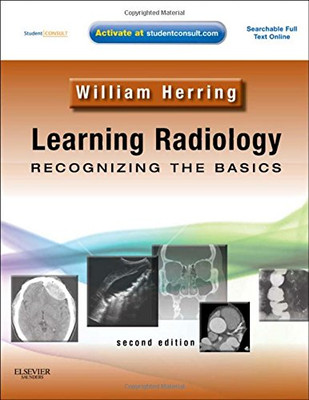 Learning Radiology: Recognizing the Basics (With STUDENT... - Herring, William