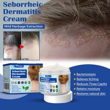 Scalp Cream Itch Relief Soothing Skin Care Moisturizing Head Skin Treatment