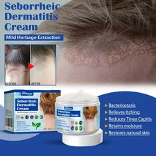Scalp Cream Itch Relief Soothing Skin Care Moisturizing Head Skin Treatment