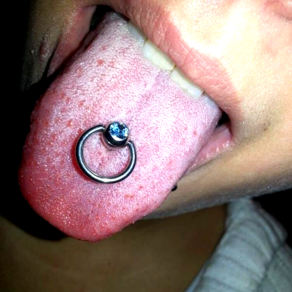 Picture 1 of 1