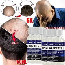 6PCS Minoxidil 5% Hair Regrowth Treatment Topical Solution for Men 6Month Supply