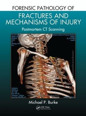 Forensic Pathology of Fractures and Mechanisms of Injury - 9781439881484
