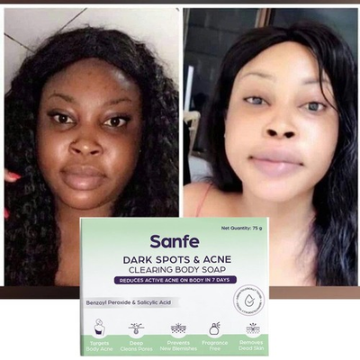 #ad #ad 🥰 BEST EXTREME whitening Face Soap no need face cream Result In 1 To 2 Use $19.49