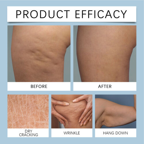 Firming Body Cream 100g Moisturizing Skin Cream Renewing Cream Firming - Imagen 6 de 12