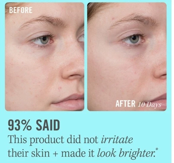 First Aid Beauty 10% Vitamin C brightening Serum - Image 2 of 4