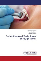 Vaishnavi Agarwal (U. A.) | Caries Removal Techniques Through Time | Taschenbuch