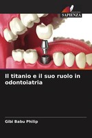 Gibi Babu Philip | Il Titanio E Il Suo Ruolo In Odontoiatria | Taschenbuch
