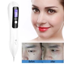 Portable LCD Dot Mole Freckle Spot Tattoo Removal Pen Beauty Skin Machine White